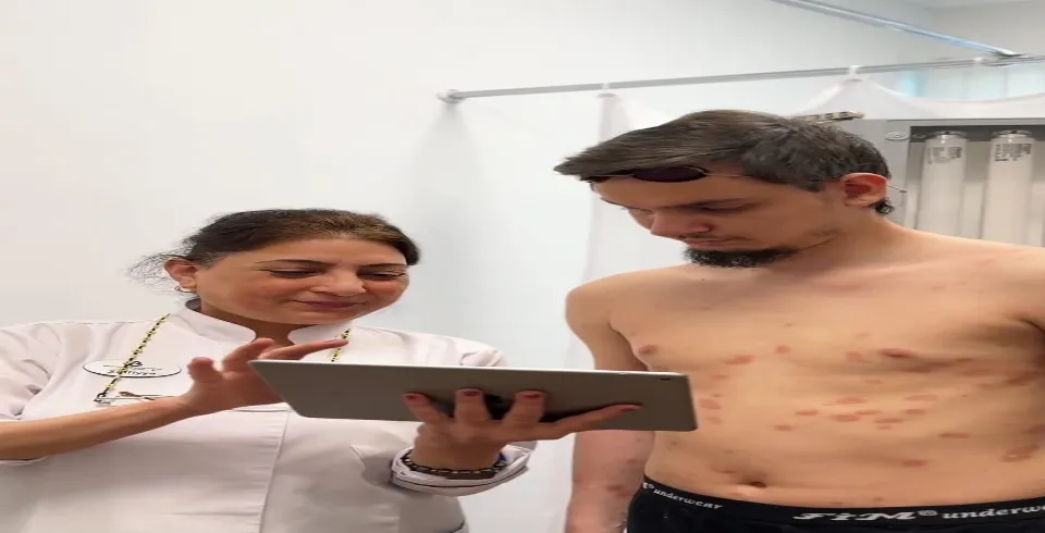 Лечение псориаза в Нафталане — Санаторий Сан Сити